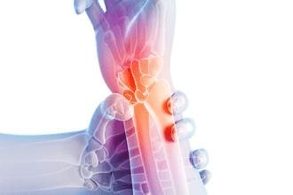 膝盖痛 手指僵 你可能得了骨关节炎哦