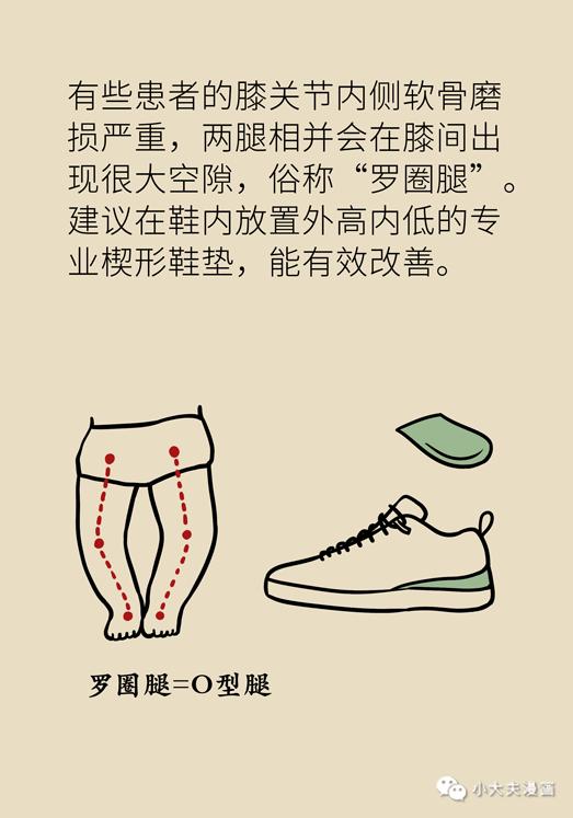 膝关节如何保养 骨性关节炎,关键是避免 屈膝过度