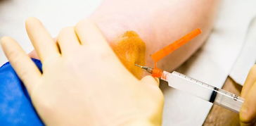 别让膝关节比你先老 这些症状一出现,抓紧去治疗