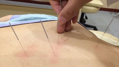 摸骨养生 轻松实用的健康之道