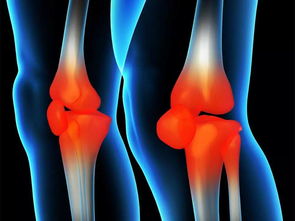 小金 x26amp 反馈 尧舜金不换养生贴风湿骨病反馈篇 摸骨养生