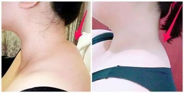 赶紧摸摸你的颈后，出现这种情况，再不重视就晚了——摸骨养生需警惕颈椎信号