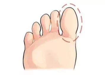 指间触达健康之旅 那个“低头摸脚”背后大有玄机的全身养生法宝