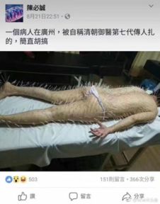 每日轻松一刻8月25日 从“打一架”到“摸骨养生”的趣味穿越